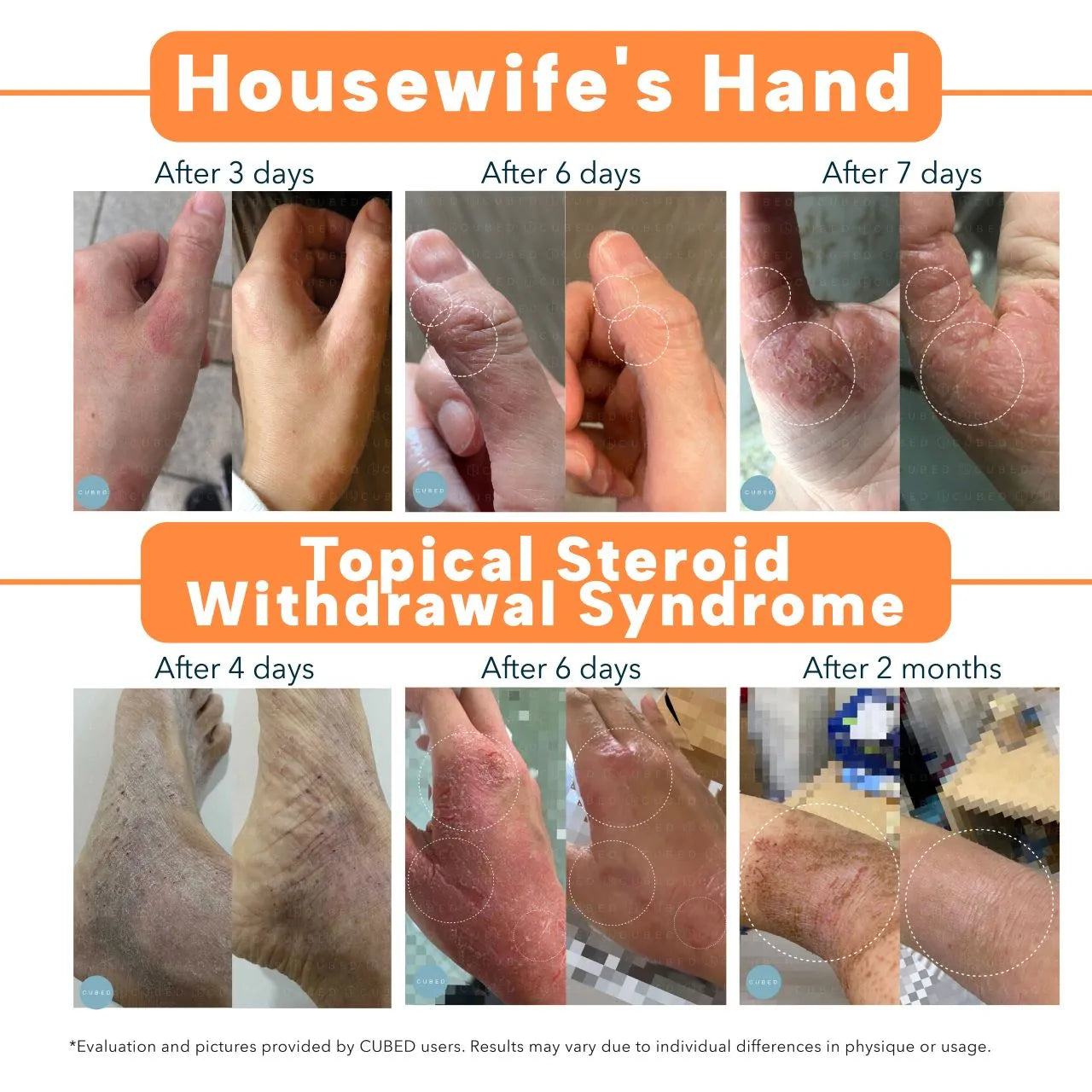 Body Eczema Relief Trio(Pre-order: ships end of 3rd week Oct)