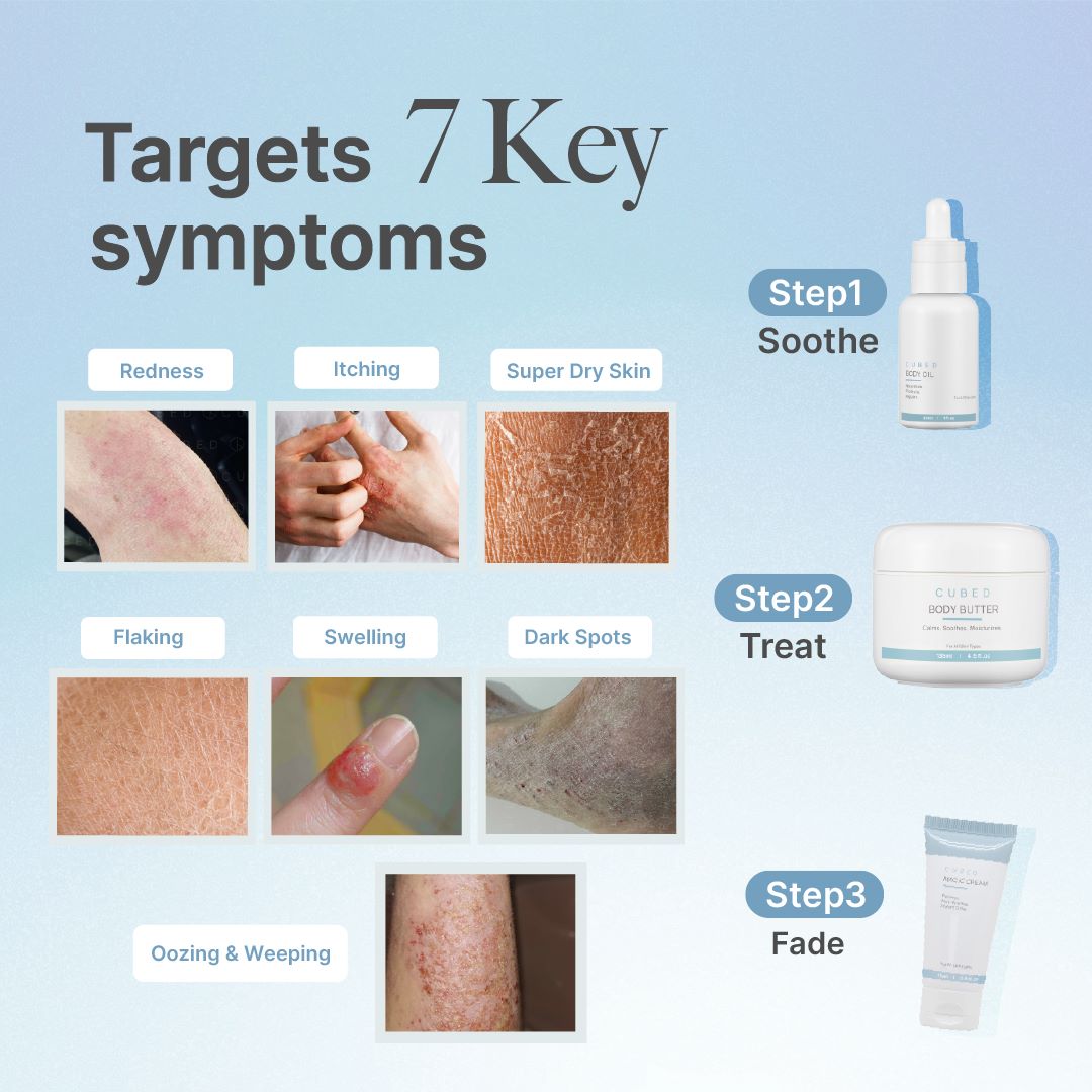 Body Eczema Relief Trio(Pre-order: ships end of 3rd week Oct)