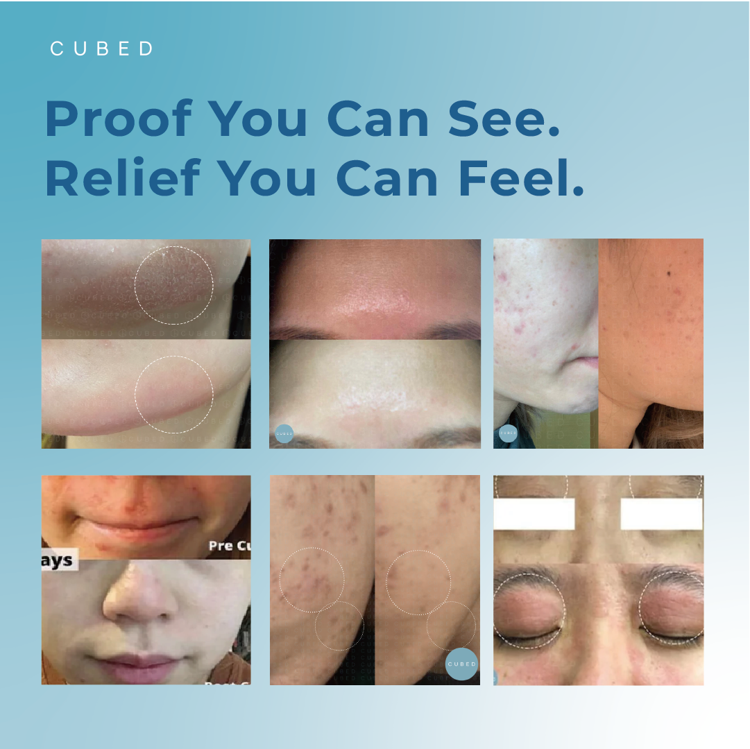 Sensitive Face Recovery Set