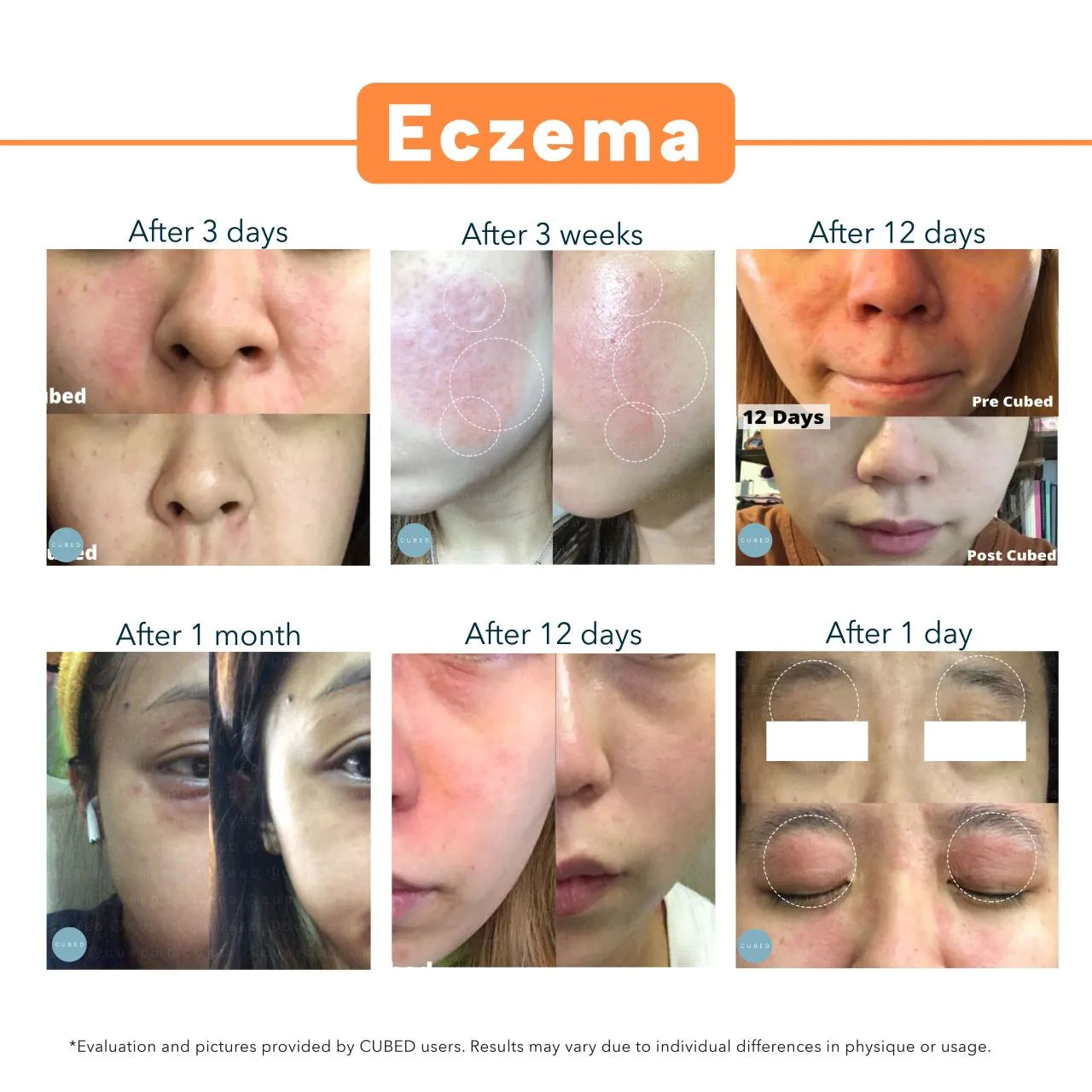 Ultimate Relief Value Set - (4 Eczema Body Butter & 1 Body Oil)(Pre-order: ships end of 3rd week Oct)