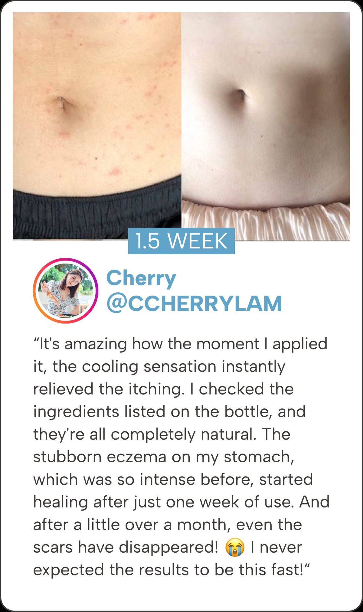 CUBED SKINCARE | Eczema, Dermatitis Atopic, and Psoriasis Relief ...