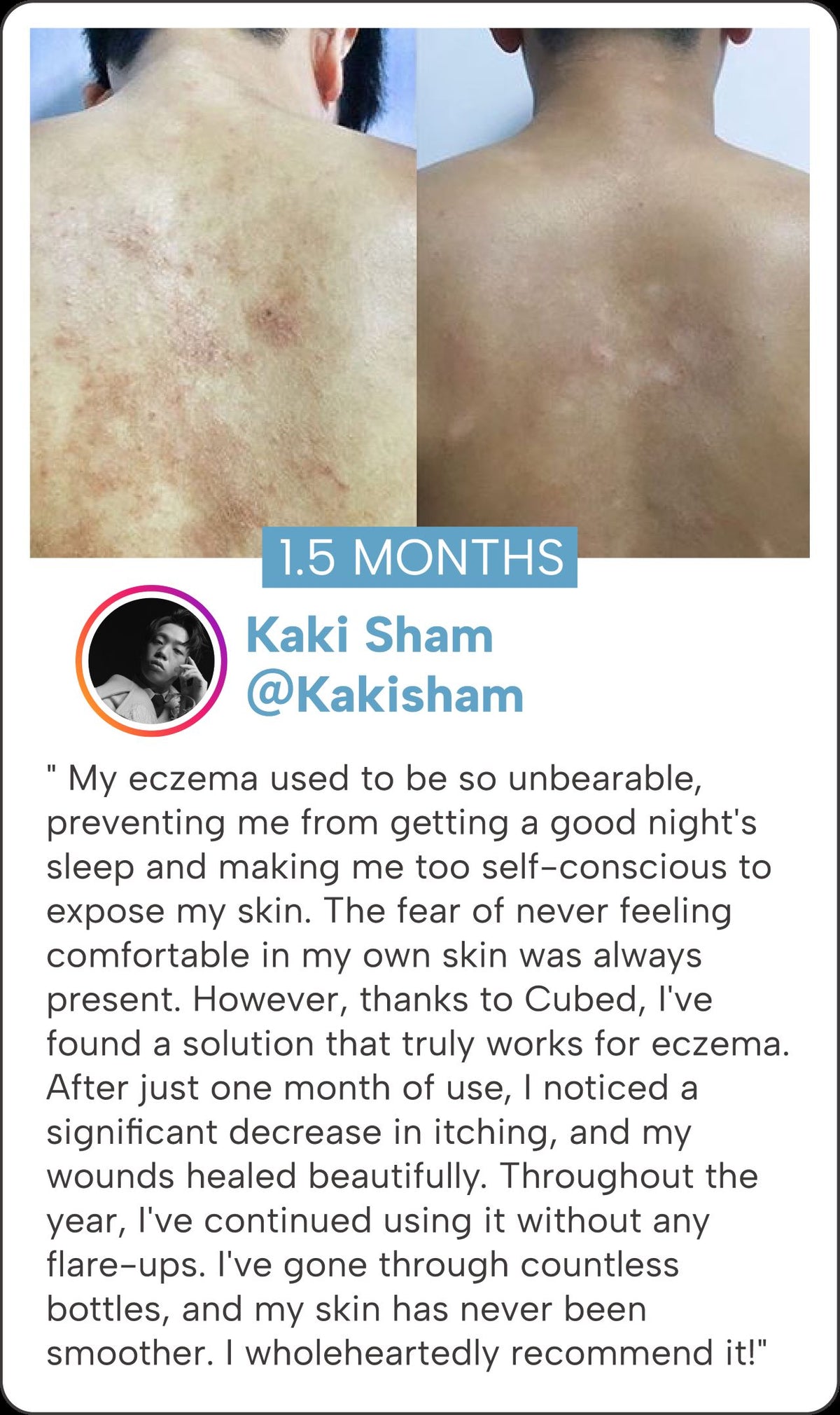 CUBED SKINCARE | Eczema, Dermatitis Atopic, and Psoriasis Relief ...