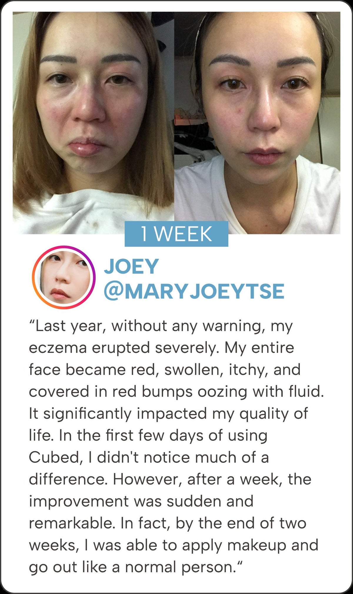 CUBED SKINCARE | Eczema, Dermatitis Atopic, and Psoriasis Relief ...