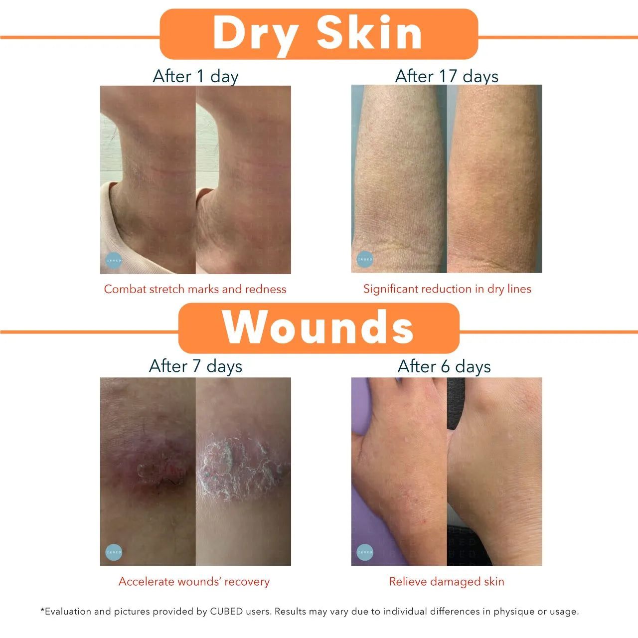 Dry Skin Therapy